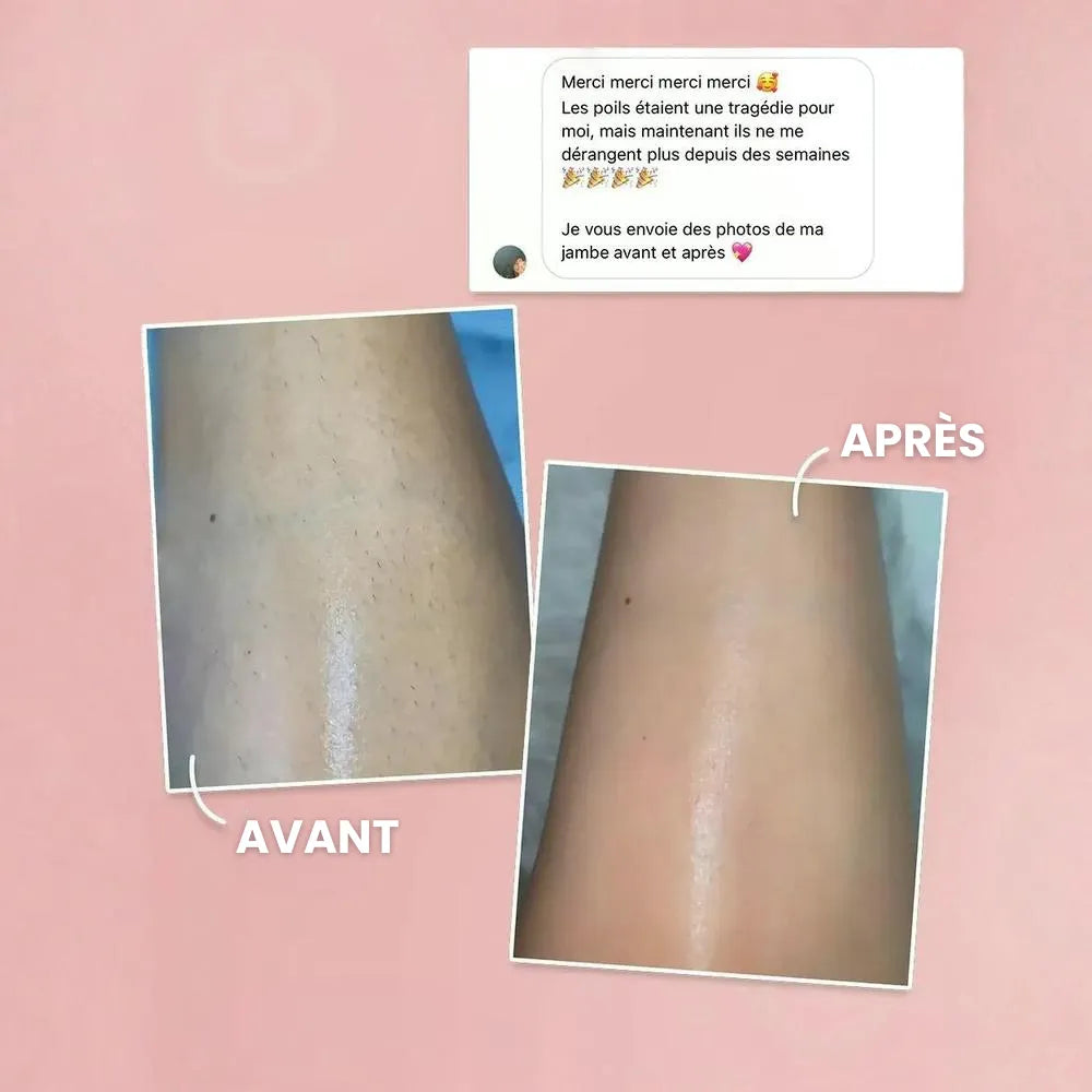 ÉpilLux© | Épilation Définitive à la Lumière Pulsée IPL